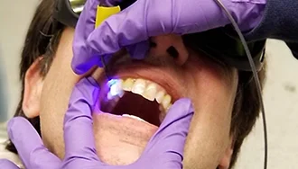 uv powder for Dental Applications